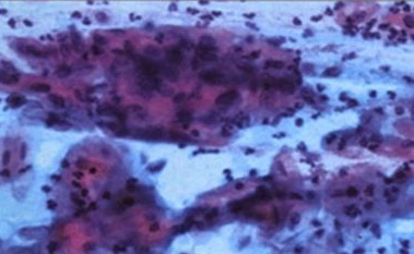 1 pav. Taip paruostas paprasto tepinelio lasteles sunku iziureti net ir patyrusiam tyrejui