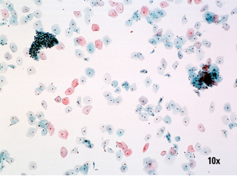 2pav THINPREP PAP preparatas yra be salutiniu priemaisu