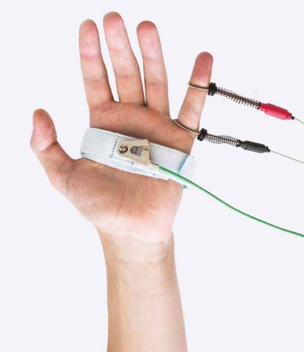 Alkuninio nervo elektroneurografijos tyrimas