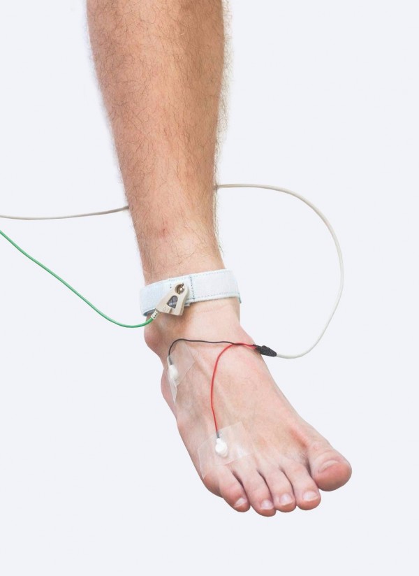 Seivinio nervo elektroneurografijos tyrimas