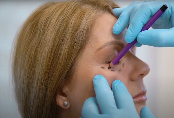 Konsultacija pries plastine operacija